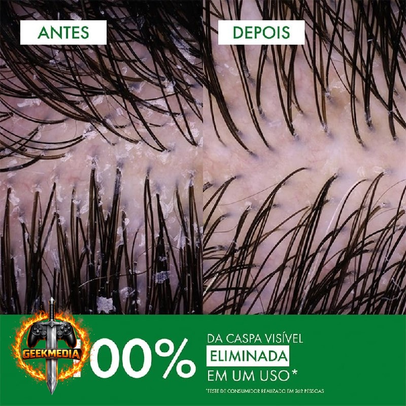 Vichy Dercos Shampoo Anticaspa - Cabelos Normais a Oleosos